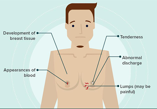 Breast Reduction