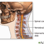 Cervical Spine Surgery1